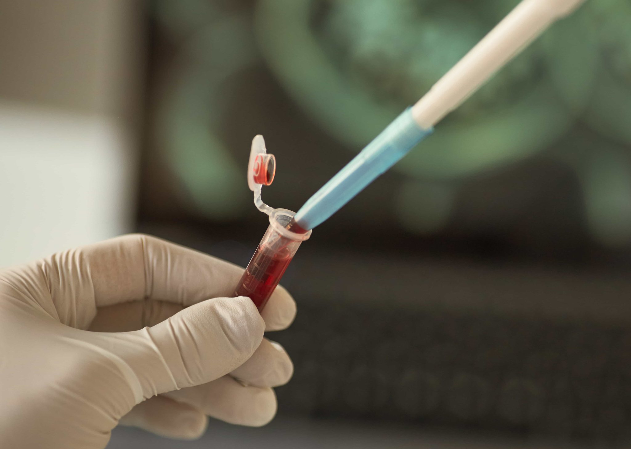 A blood sample being pipetted for diagnostic testing